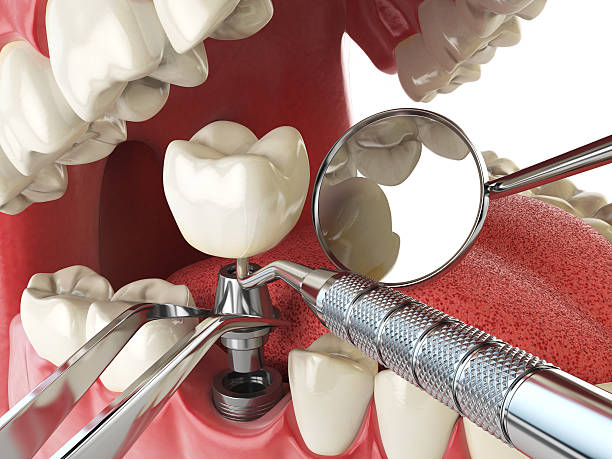Best Emergency Treatment for Toothache in Idalou, TX